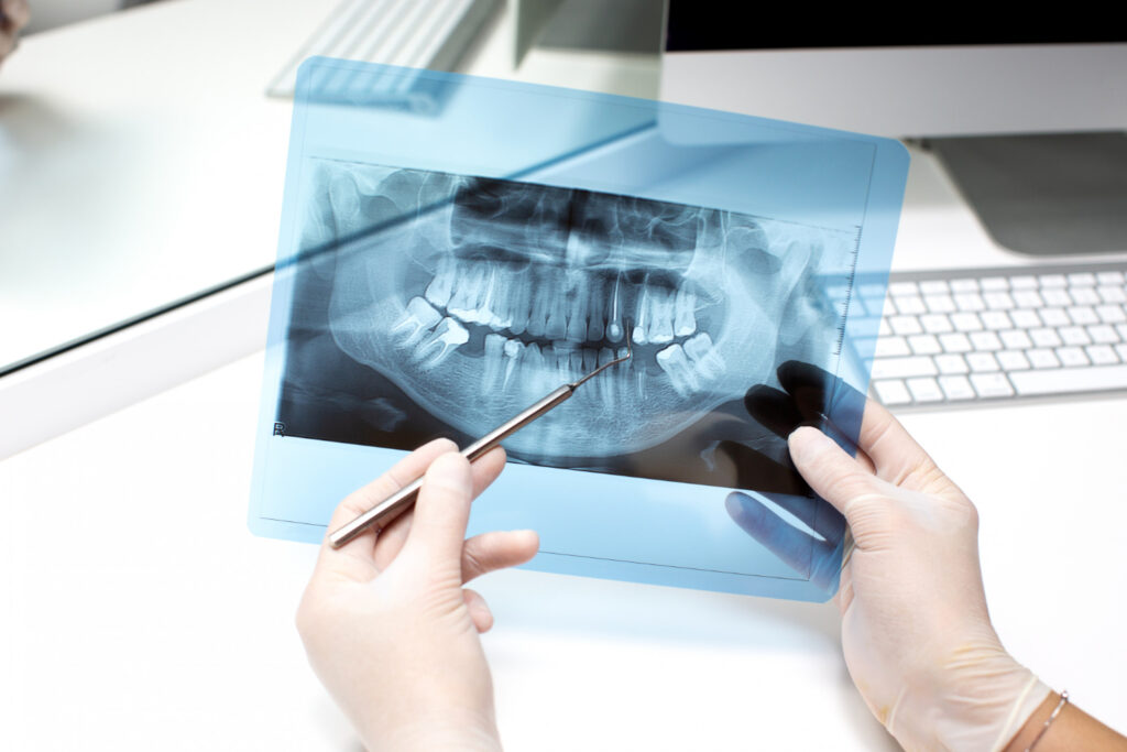 chirurgia stomatologiczna Ruda Śląska konsultacja i diagnostyka