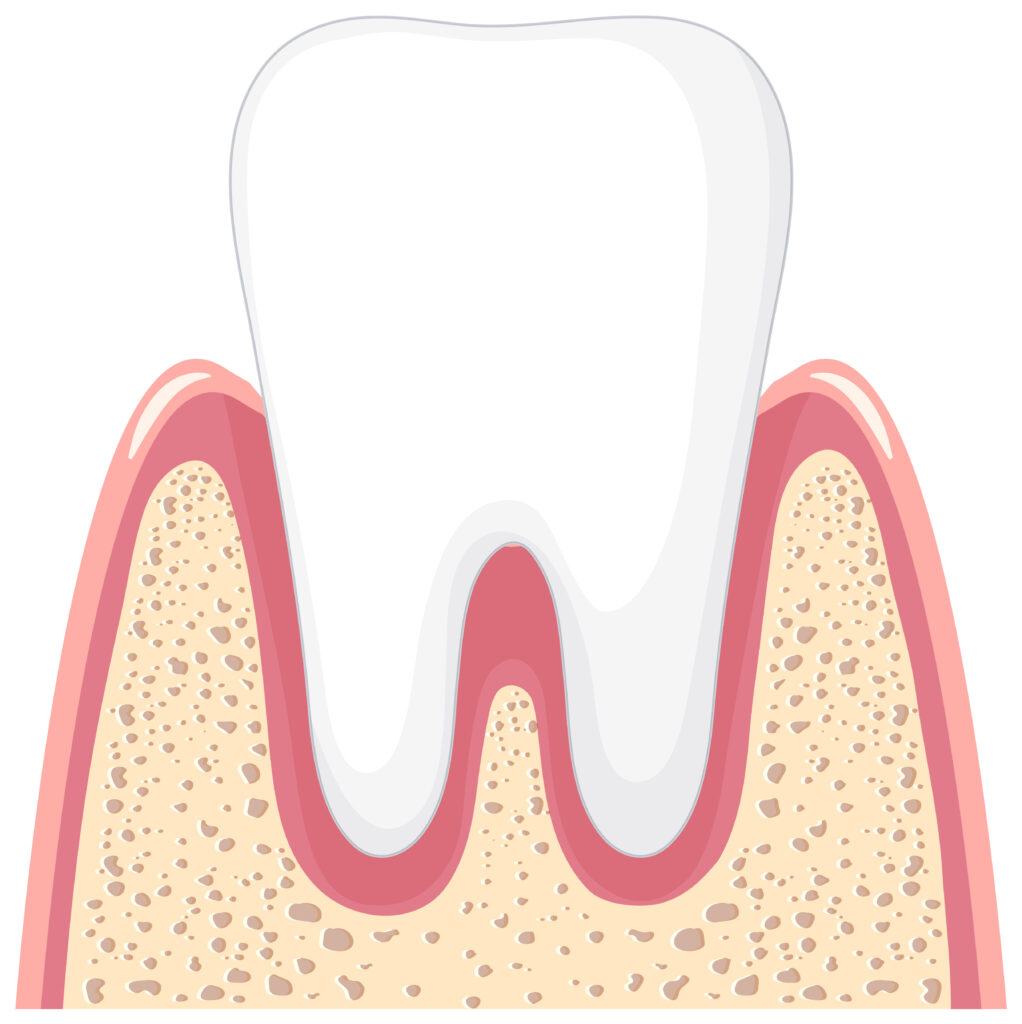 leczenie chorób przyzębia periodontologia Ruda Śląska
