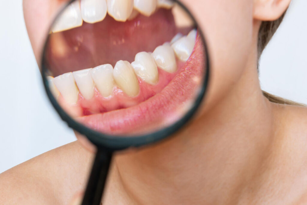 periodontologia leczenie dziąseł Ruda Śląska
